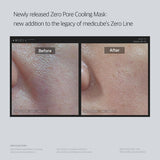 Medicube Zero Pore Cooling Mask (1 PC) - Kiyoko Beauty