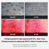 Medicube Red Succinic Acid Peeling Pad (70 PCs) - Kiyoko Beauty