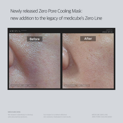 Medicube Zero Pore Cooling Mask (1 PC) - Kiyoko Beauty