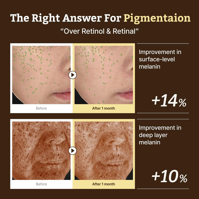 Dr. Reju-All Advanced Retino-Mela Serum (30ml) - Kiyoko Beauty