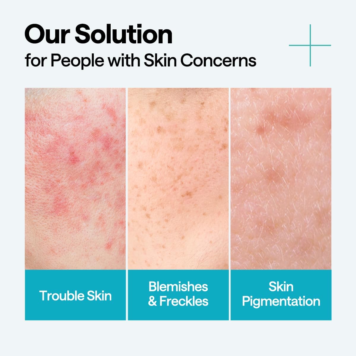 MEDIHEAL Madecassoside Blemish Repair Serum (40ml)