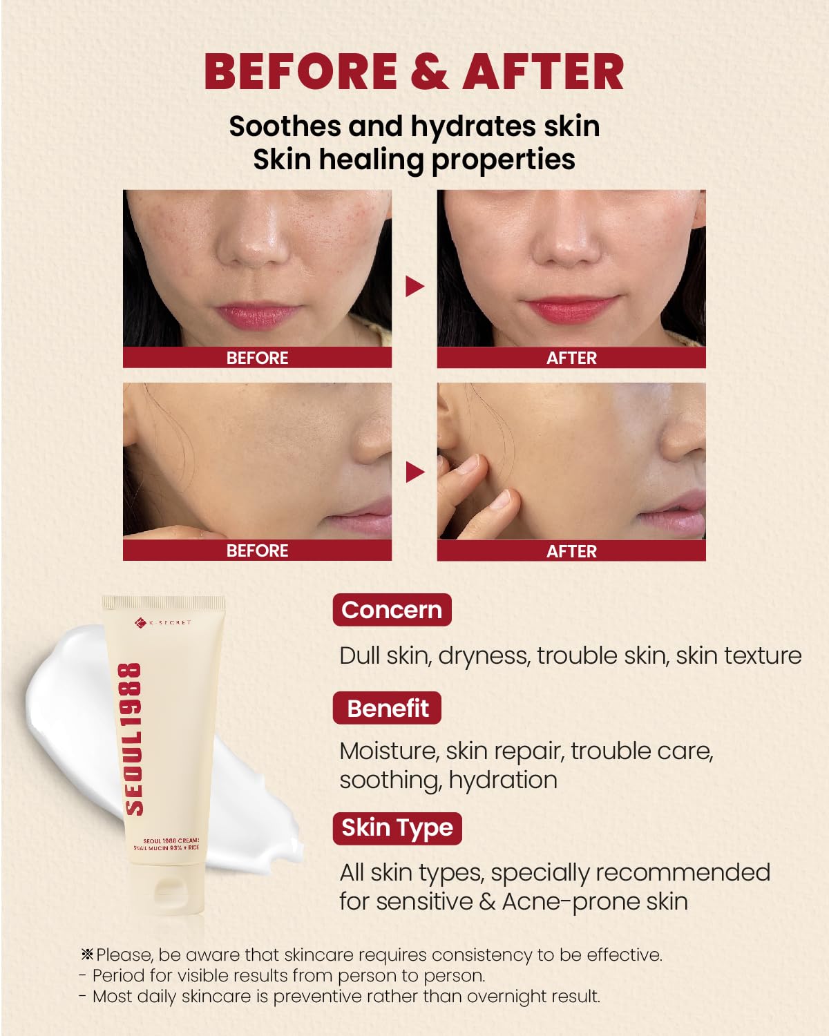 K-SECRET SEOUL 1988 Cream: Snail Mucin 93% + Rice (100ml) | Kiyoko