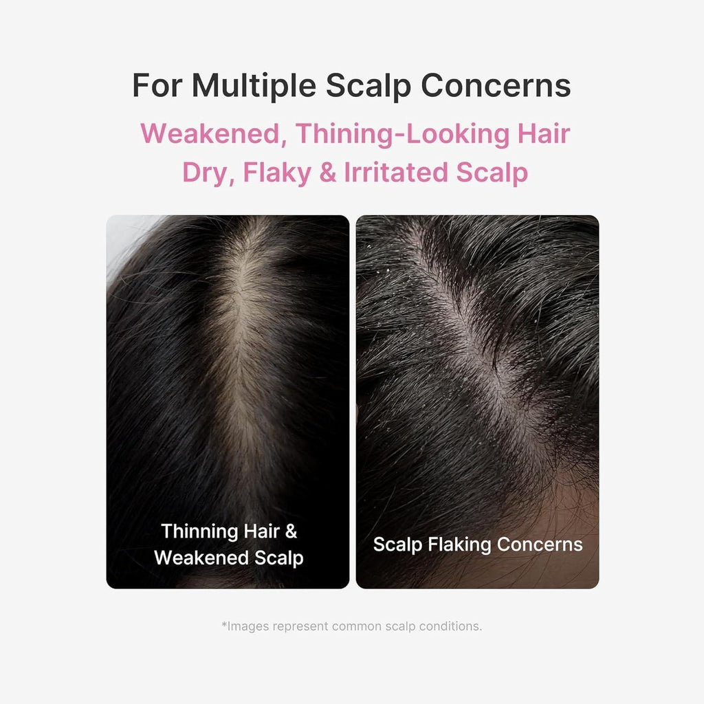 Medicube Rosemary PDRN Scalp Serum (20ml)