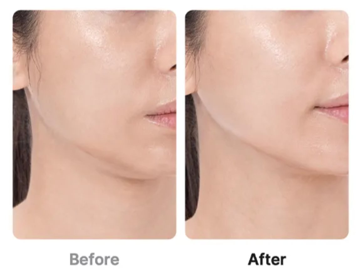 Medicube Age-R Booster Pro | Kiyoko Beauty