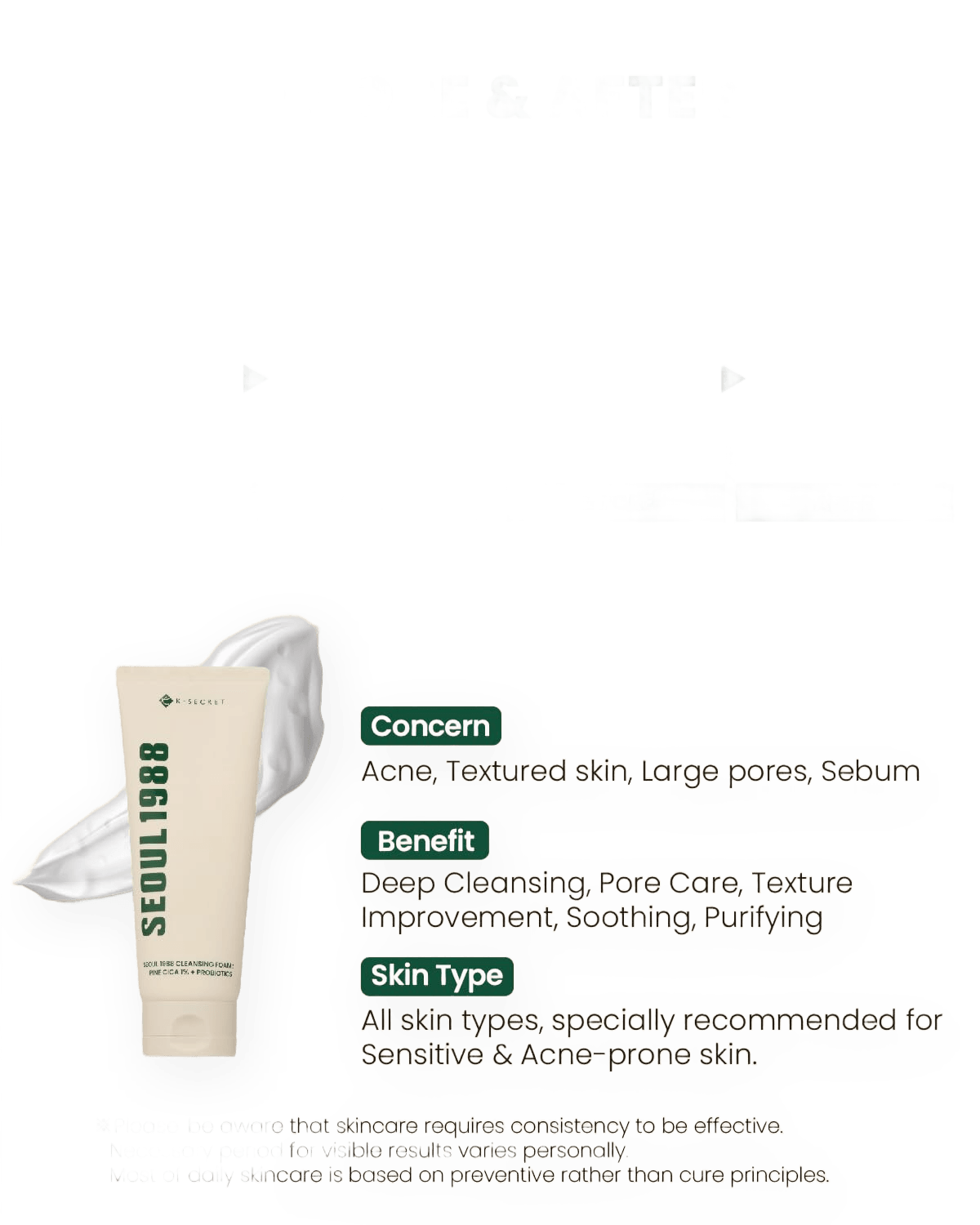 KSECRET SEOUL 1988 Cleansing Foam: Pine Cica 1% + Probiotics (150ml) - Kiyoko Beauty